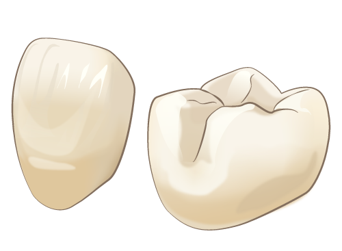 CADCAM冠は保険適用の白い歯です
